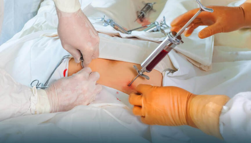 bone marrow transplant hospitalin india